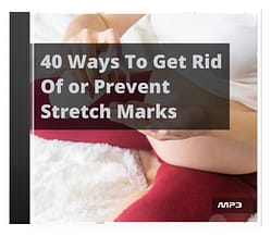 40 Ways To Get Rid Of or Prevent Stretch Marks Audio Book Plus Ebook